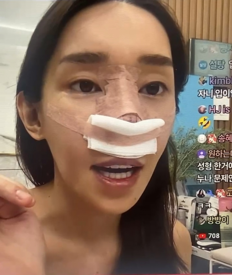 최근 15번째 코 수술을 마친 트랜스젠더 꽃자.JPG | 인스티즈