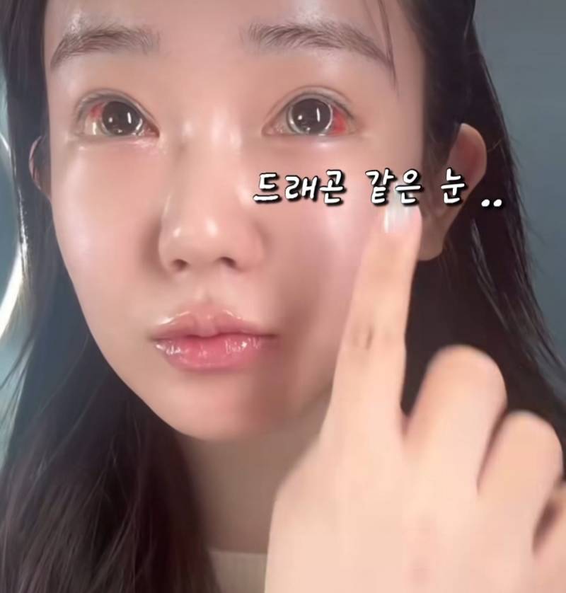 현재 여론 살벌한 눈동자 성형수술.JPG (충격주의) | 인스티즈