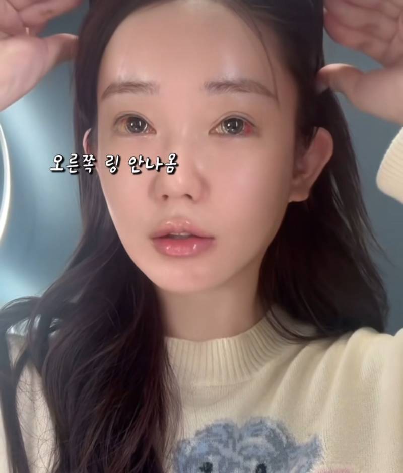 현재 여론 살벌한 눈동자 성형수술.JPG (충격주의) | 인스티즈