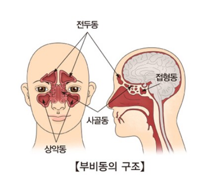 눈알이 빠질것 같고 편두통이 오지며 갑자기 치통이 생긴다면 바로 '이 병'이다 | 인스티즈