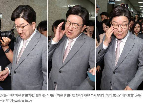 [포토] 뺨 맞은 권성동 | 인스티즈