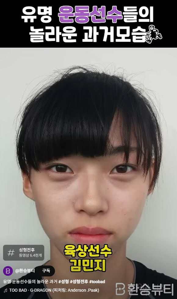 카리나 닮은꼴 육상선수 김민지 성형 전 후.jpg