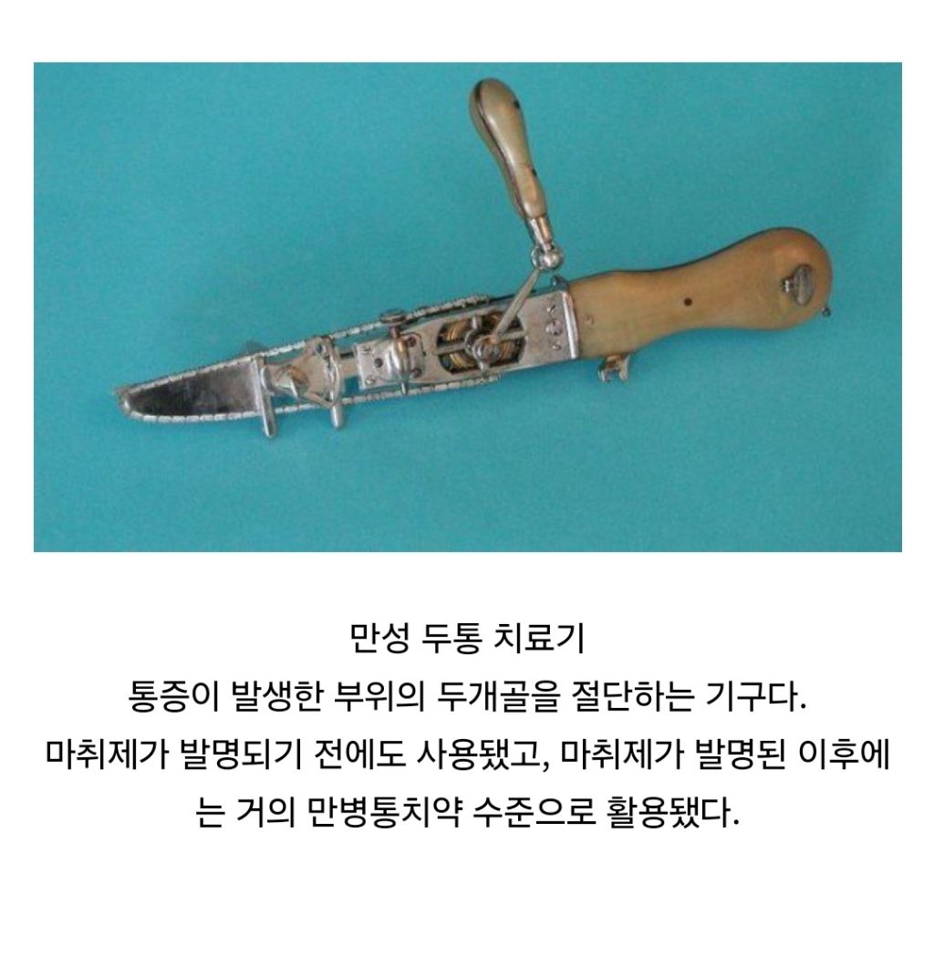 옛날에 사용됐다는 만성 두통 치료기 | 인스티즈