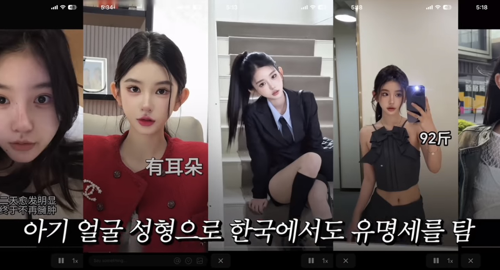 중녀 미감 만들어준다는 왕징 성형외과 다녀온 유튜버.jpg | 인스티즈