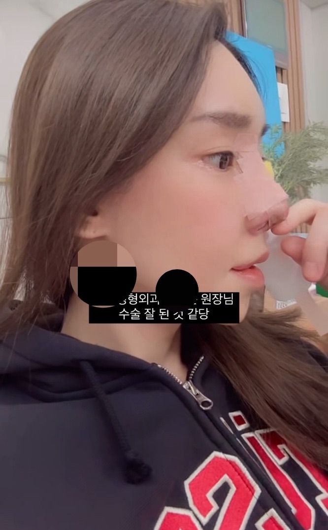 최근 15번째 코 수술을 마친 트랜스젠더 꽃자.JPG