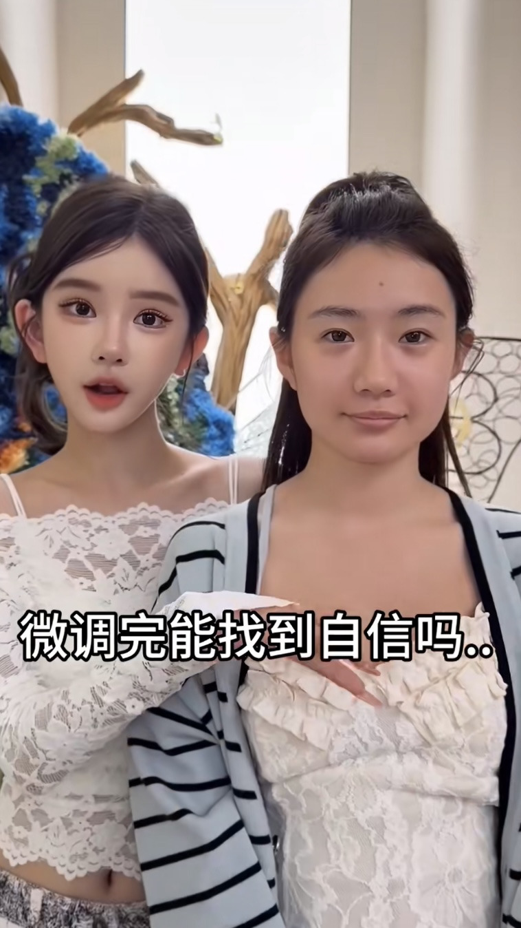 중녀 미감 만들어준다는 왕징 성형외과 다녀온 유튜버.jpg | 인스티즈
