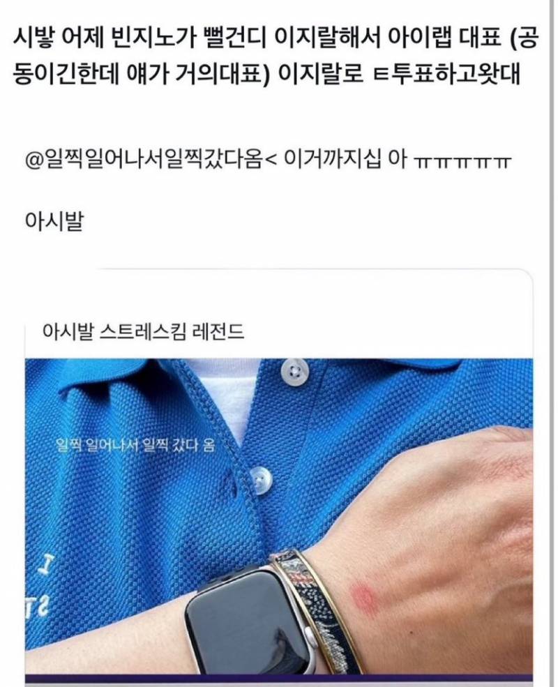 빈지노가 뻘건디 이 𝙕𝙄𝙍𝘼𝙇 해서