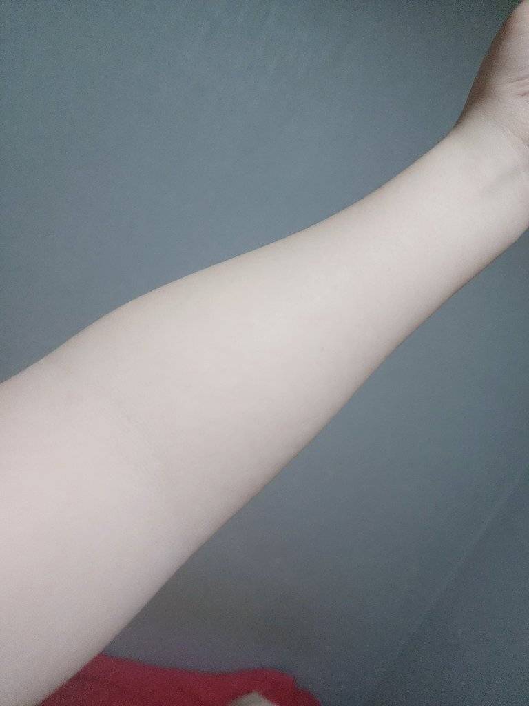 현재 간호사가 가장 기피한다는 혈관 없는 사람.JPG | 인스티즈