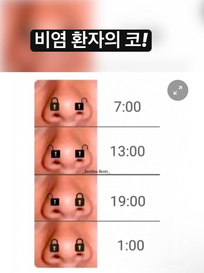 비염 환자의 코! | 인스티즈