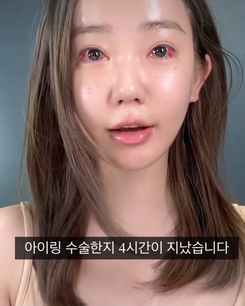 현재 여론 살벌한 눈동자 성형수술.JPG (충격주의) | 인스티즈